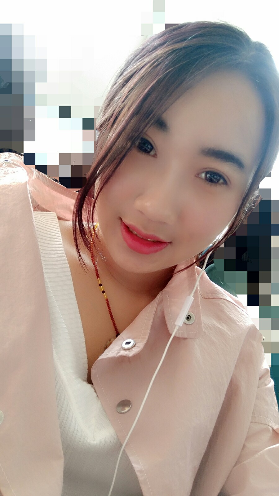 8.15號割的雙眼皮 感謝慕醫(yī)生