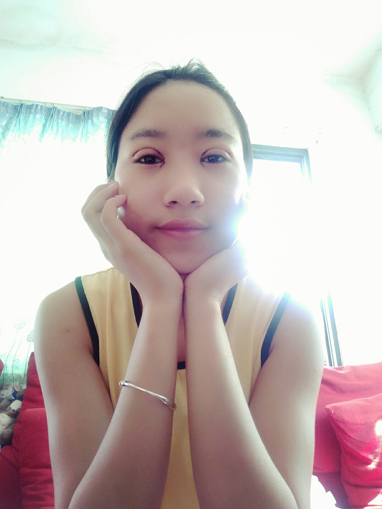 8.15號割的雙眼皮 感謝慕醫(yī)生