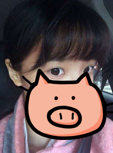 成都玉之光發(fā)際線種植 果不錯(cuò)~