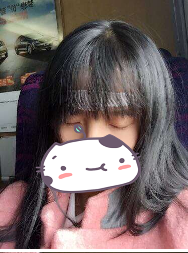 成都玉之光發(fā)際線種植 果不錯(cuò)~