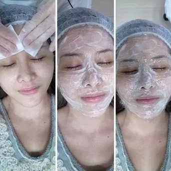 成都玉之光激光嫩膚經(jīng)歷 愛美的MM一定要看