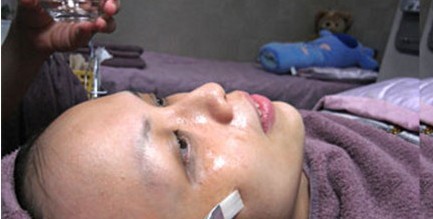 成都玉之光做了杏仁酸換膚 皮膚真的凈白無瑕了