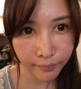 成都玉之光激光嫩膚經(jīng)歷 愛美的MM一定要看