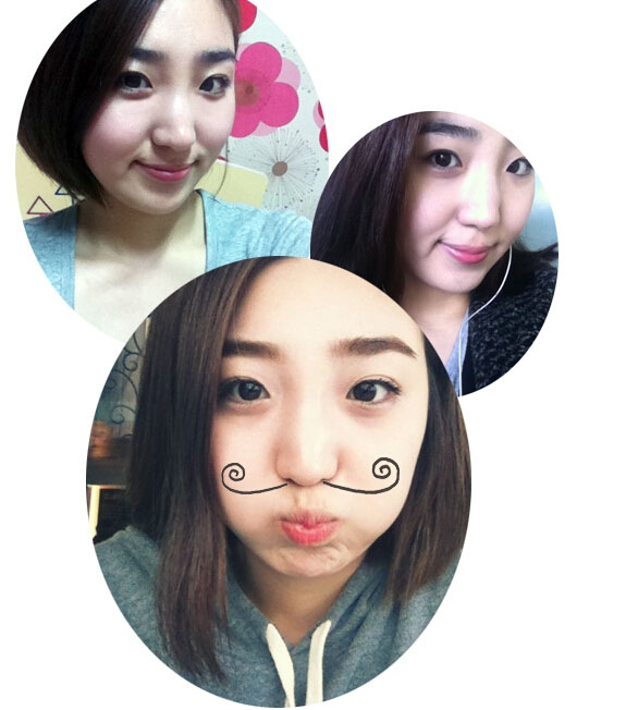 深圳希思崔院長隆鼻整形 擺脫了豬妹妹的稱號