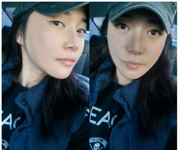 柳大烈給我做的改臉型手術(shù) 求圍觀！