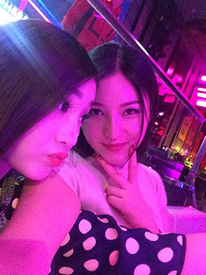 北京常好麗格做假體隆鼻3個月