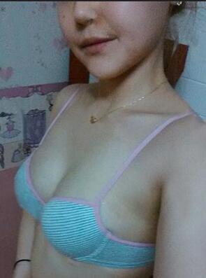 成都艾米麗自體脂肪隆胸三個(gè)月啦~