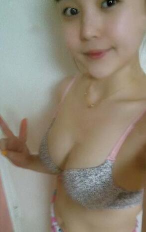 成都艾米麗自體脂肪隆胸三個(gè)月啦~