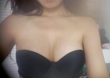 成都艾米麗自體脂肪豐胸前后對(duì)比
