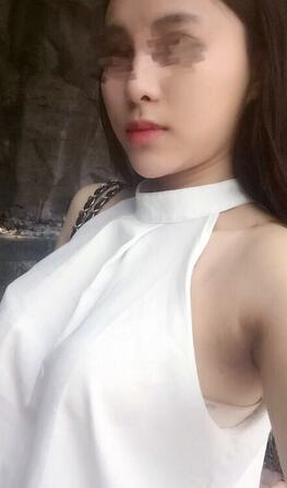 艾米麗自體脂肪隆胸恢復(fù)經(jīng)歷