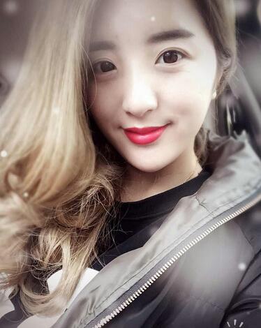 愛悅麗格玻尿酸豐臉頰日記分享