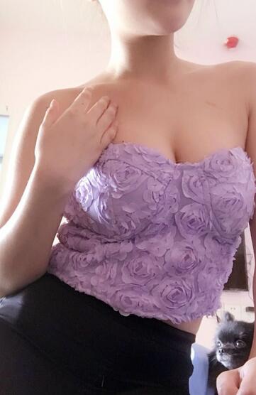 自體脂肪豐胸對(duì)比圖 抽脂隆胸十天