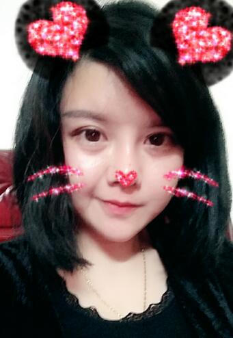 假體隆鼻兩個(gè)月后的感覺 隆鼻整形手術(shù)恢復(fù)日記