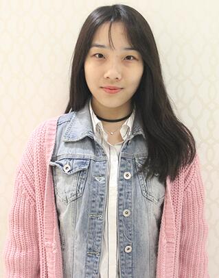 開眼角加雙眼皮15天恢復(fù)圖