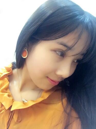 開眼角加雙眼皮15天恢復(fù)圖