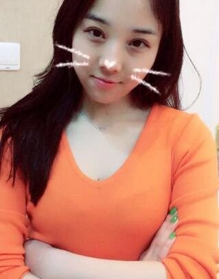 開眼角加雙眼皮15天恢復(fù)圖