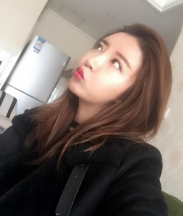 自體脂肪填充全臉1個月經(jīng)歷