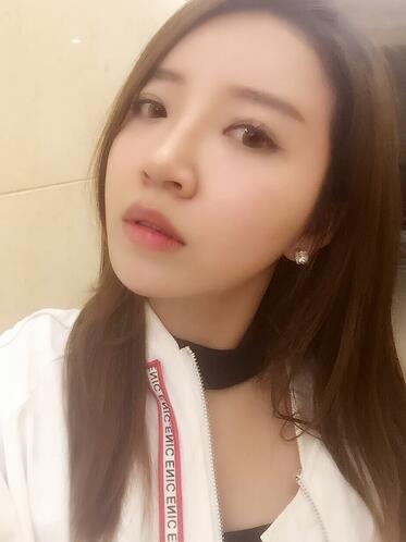 自體脂肪填充全臉1個月經(jīng)歷