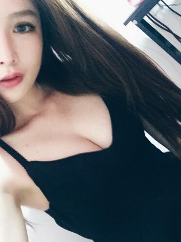 自體脂肪隆胸20天經(jīng)歷