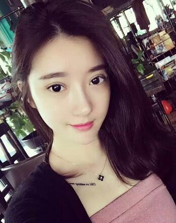 雙眼皮修復(fù)+自體脂肪填充恢復(fù)日記