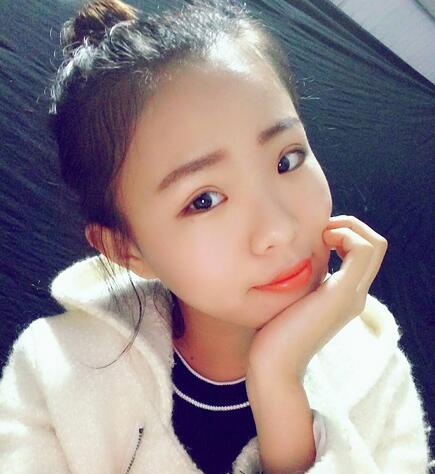 割雙眼皮術(shù)后恢復(fù)過程 全切雙眼皮3個月