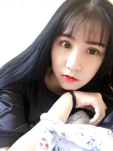 切的雙眼皮90天恢復(fù)過(guò)程圖