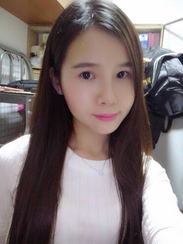 自體脂肪填充后2個(gè)月圖