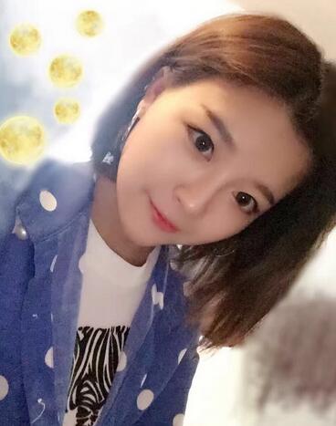 雙眼皮+開(kāi)眼角3個(gè)月恢復(fù)過(guò)程圖