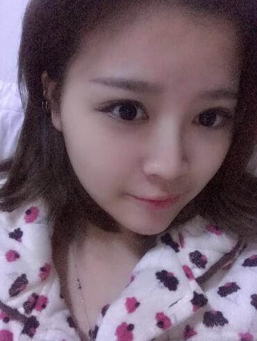 雙眼皮+開(kāi)眼角3個(gè)月恢復(fù)過(guò)程圖