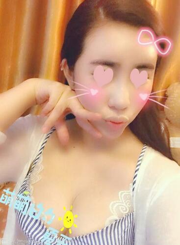 自體脂肪豐胸之后多久能上班 北京麗星豐胸恢復(fù)紀(jì)實(shí)