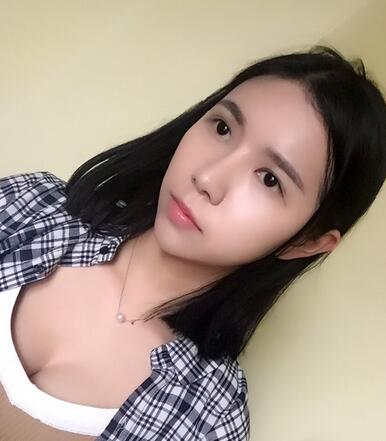 自體脂肪填充恢復(fù)日志 自體脂肪填充太陽穴+額頭