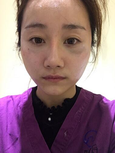 上海潔銘線D提升三個(gè)月后的圖片