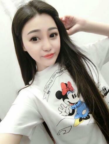 上海九院李圣利隆鼻整形真實(shí)恢復(fù)期圖片