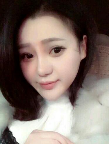 上海九院李圣利隆鼻整形真實(shí)恢復(fù)期圖片