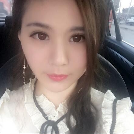 武漢樂美開眼角+雙眼皮3個月恢復圖片