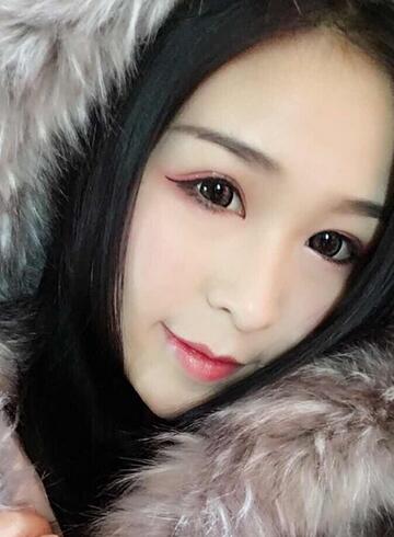 杭州大麥微針龍都整形開眼角+割雙眼皮恢復記錄