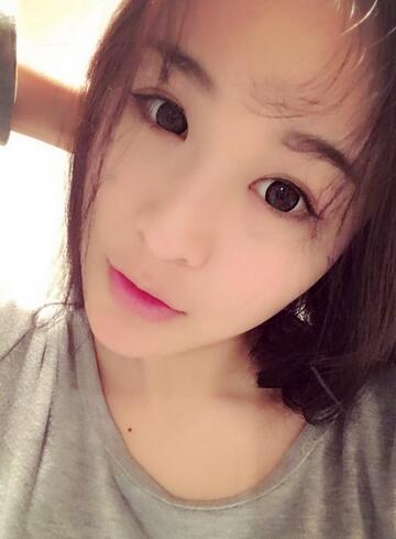 杭州大麥微針龍都整形開眼角+割雙眼皮恢復記錄