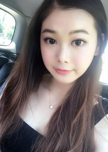 韓式微創(chuàng)雙眼皮恢復(fù)圖 深圳妍熙雙眼皮半年