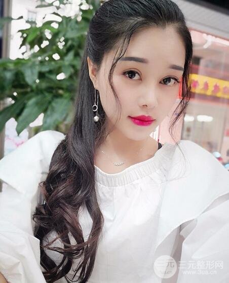 鼻頭縮小術(shù)過程圖,鼻頭縮小恢復(fù)日記