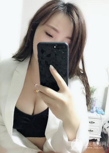 自體脂肪豐胸3個(gè)月分享，活細(xì)胞豐胸術(shù)后果逼真更自然