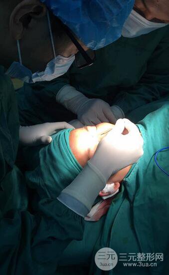 隆鼻鼻翼縮小全過程和術(shù)后照片分享,隨意揉捏很OK