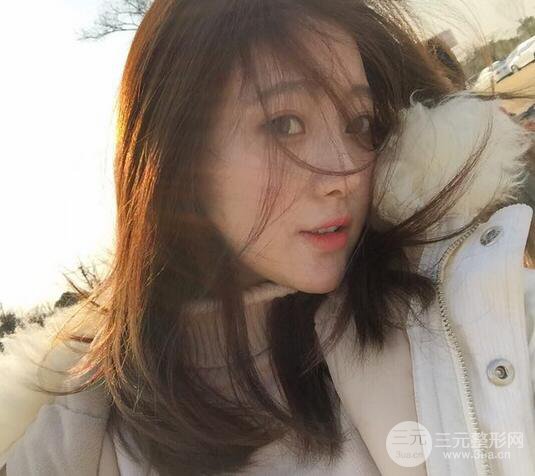 肋軟骨隆鼻+歪鼻矯正案例