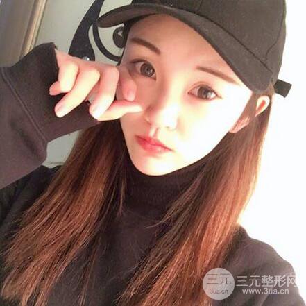 下頜角磨骨整形全過程分享,附上術后恢復照片~