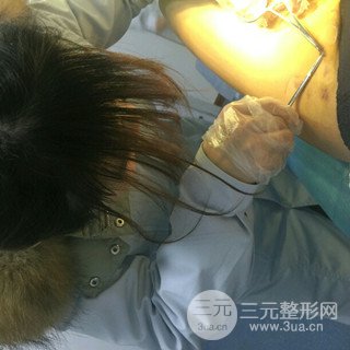 大腿抽脂果好到不行、瘦十厘米不是問題