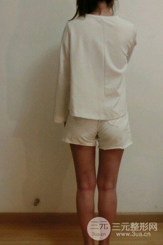 大腿抽脂果好到不行、瘦十厘米不是問題