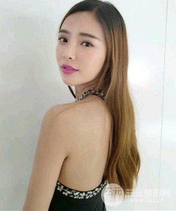 模特做隆鼻整形真實(shí)日記分享，附上恢復(fù)過程圖