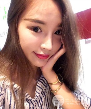 模特做隆鼻整形真實(shí)日記分享，附上恢復(fù)過程圖