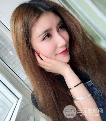 網(wǎng)絡主播做自體脂肪豐太陽穴真實案例分享，果杠杠的