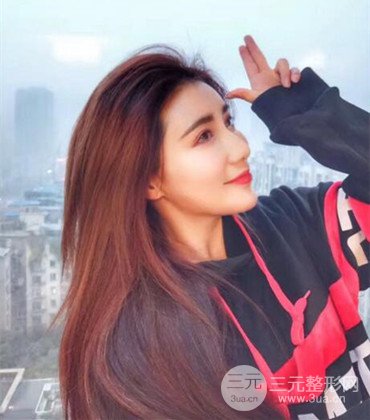 網(wǎng)絡主播做自體脂肪豐太陽穴真實案例分享，果杠杠的