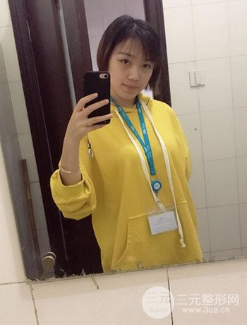 北京內(nèi)切祛眼袋真人案例果對比分享，年輕十歲不是夢